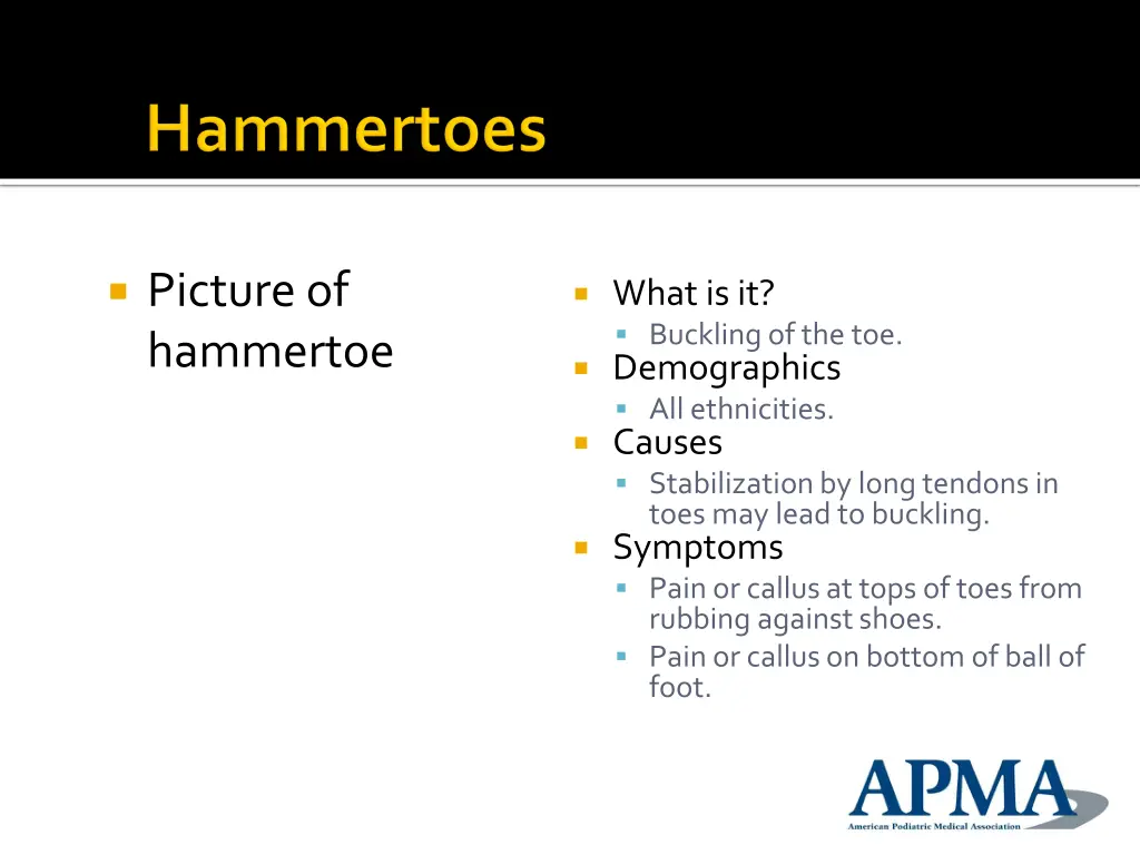 picture of hammertoe