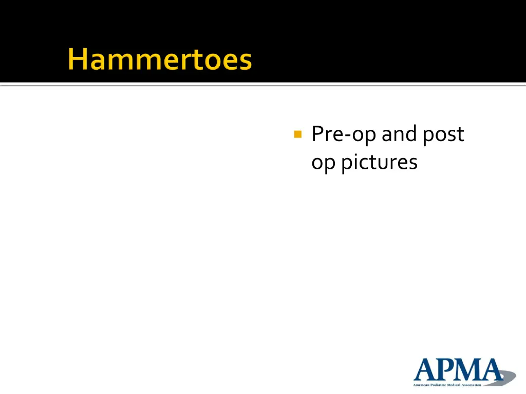 pre op and post op pictures