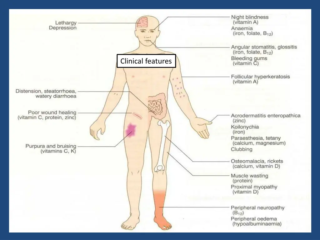 clinical features