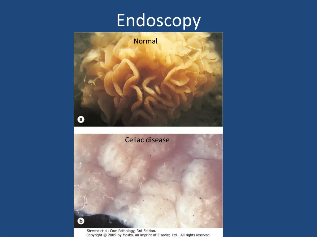 endoscopy