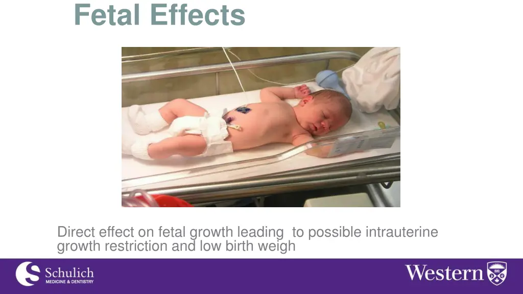 fetal effects