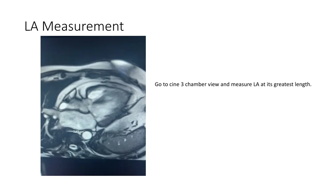 la measurement