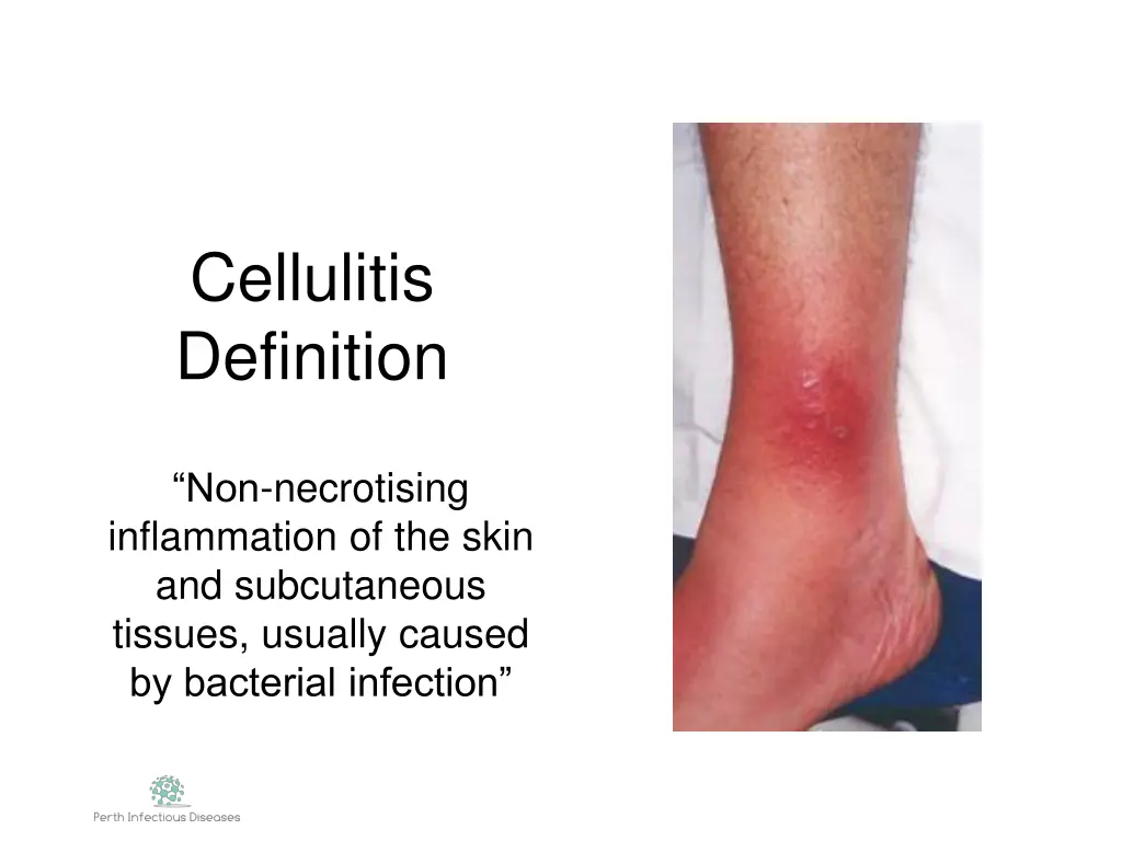 cellulitis definition