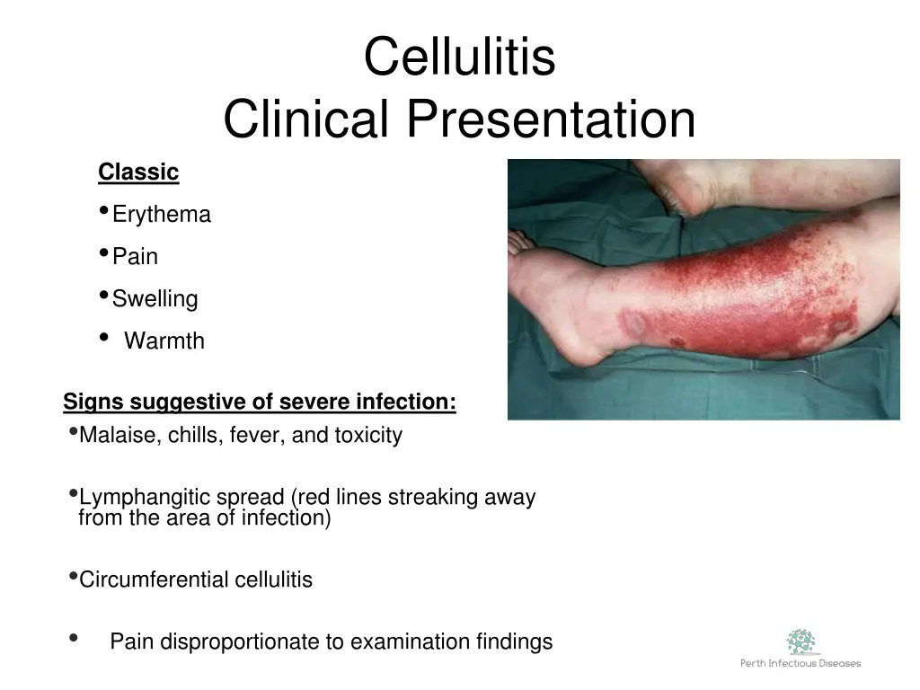 cellulitis