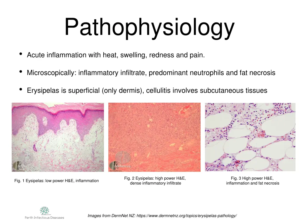 pathophysiology