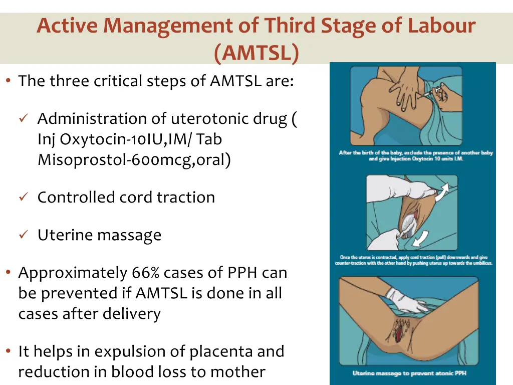 active management of third stage of labour amtsl