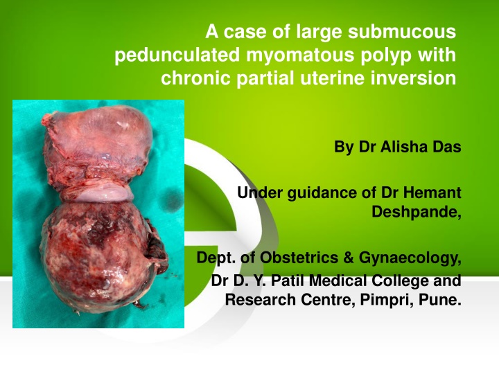 a case of large submucous pedunculated myomatous