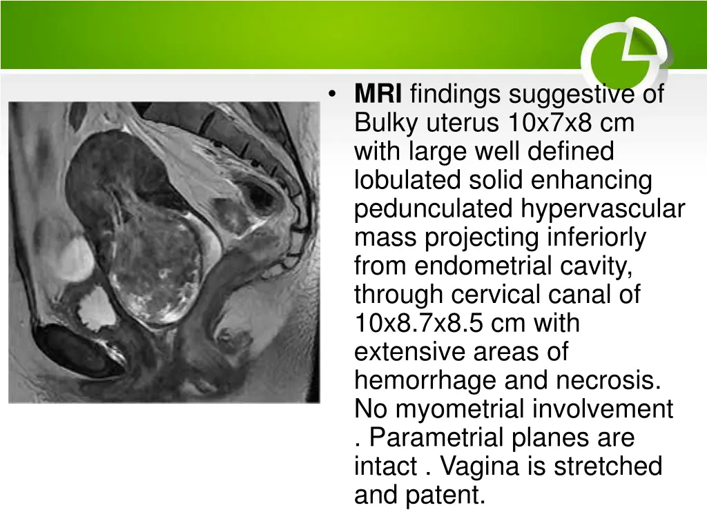 mri findings suggestive of bulky uterus 10x7x8