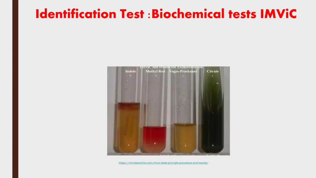 identification test biochemical tests imvic