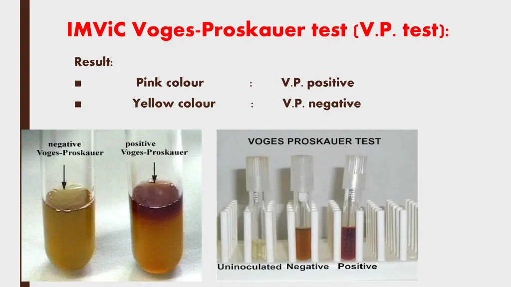 imvic voges proskauer test v p test 3