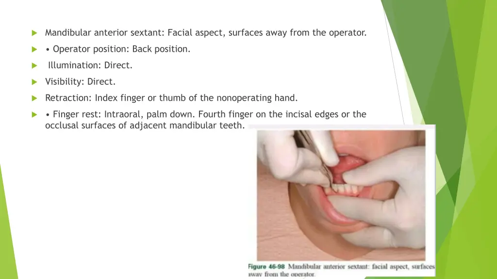 mandibular anterior sextant facial aspect 1