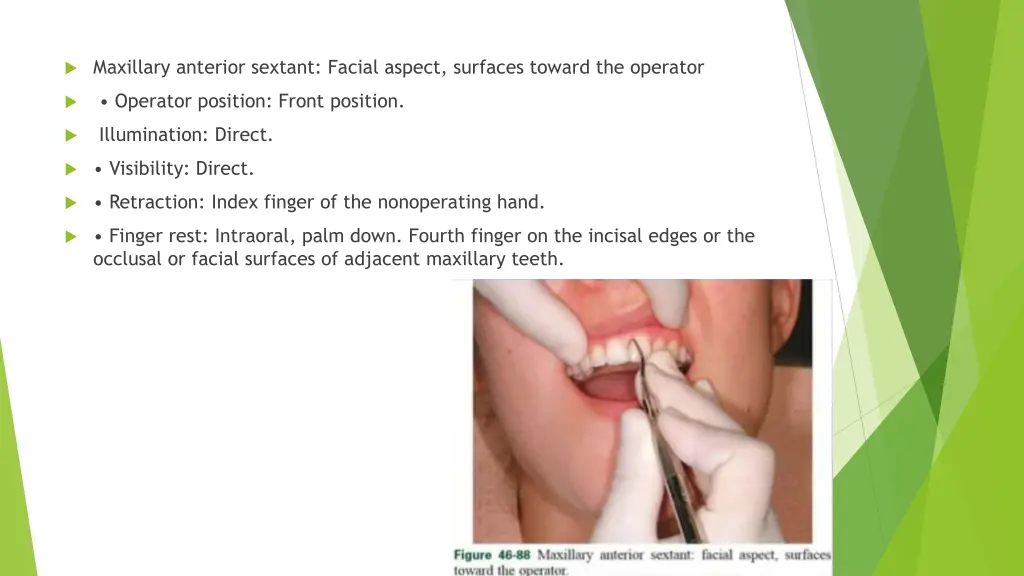 maxillary anterior sextant facial aspect surfaces 1