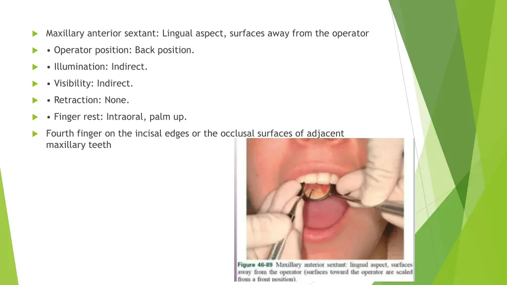 maxillary anterior sextant lingual aspect