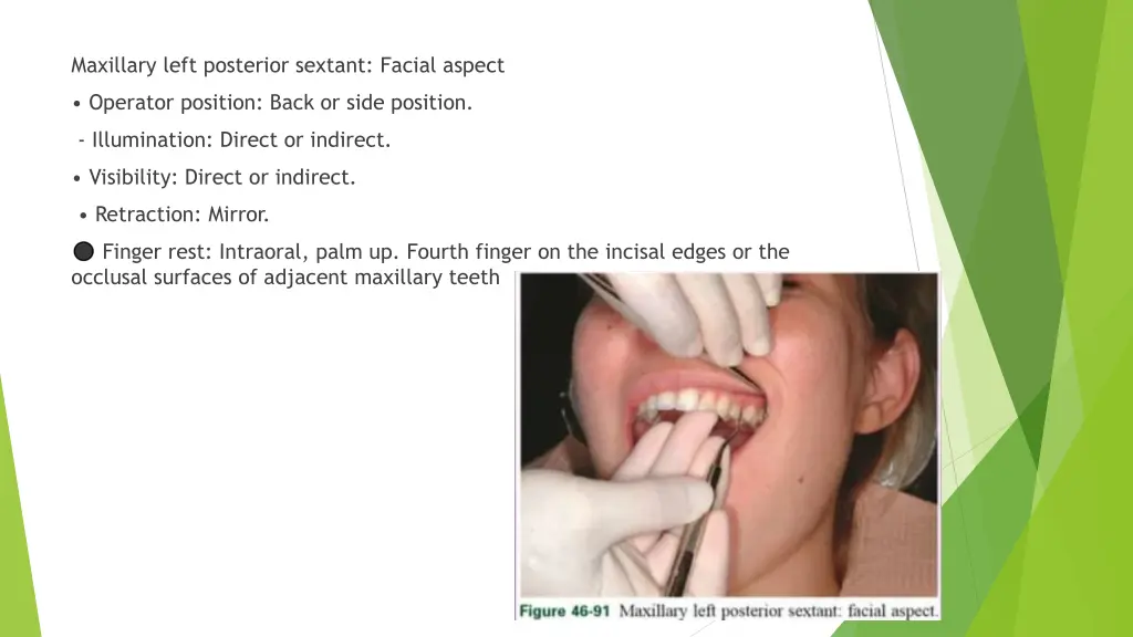 maxillary left posterior sextant facial aspect 1