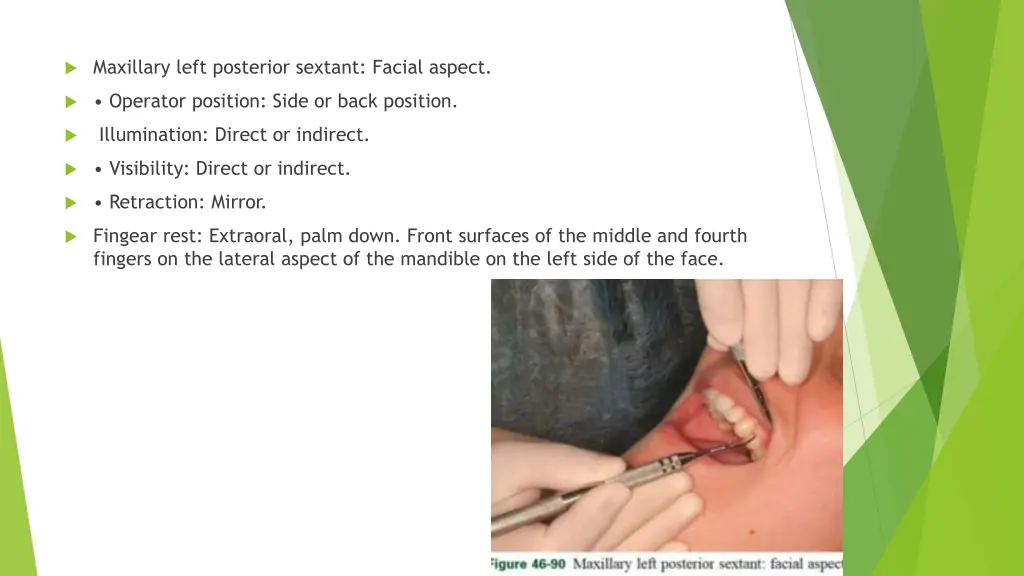 maxillary left posterior sextant facial aspect