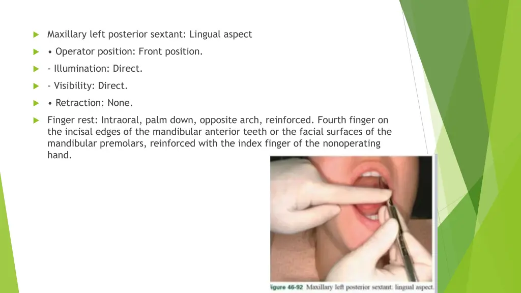 maxillary left posterior sextant lingual aspect