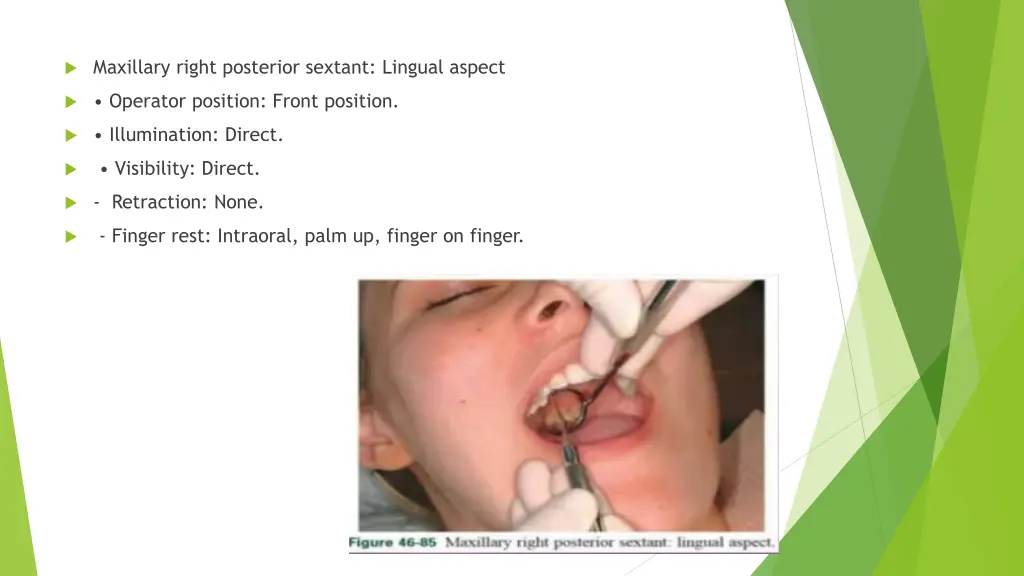 maxillary right posterior sextant lingual aspect