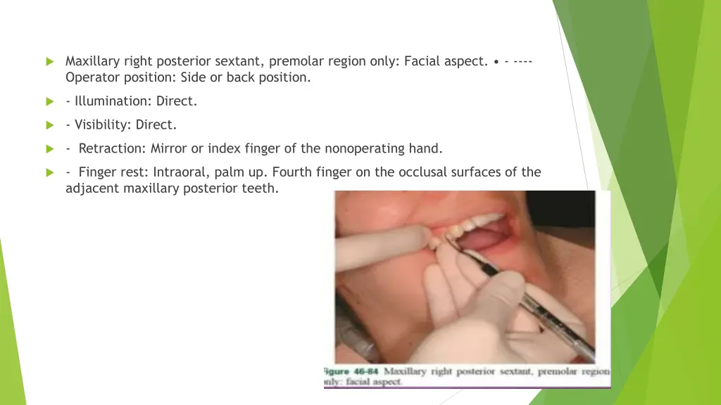 maxillary right posterior sextant premolar region