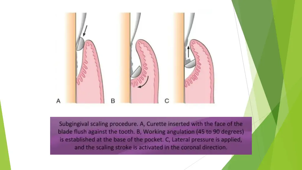 slide19