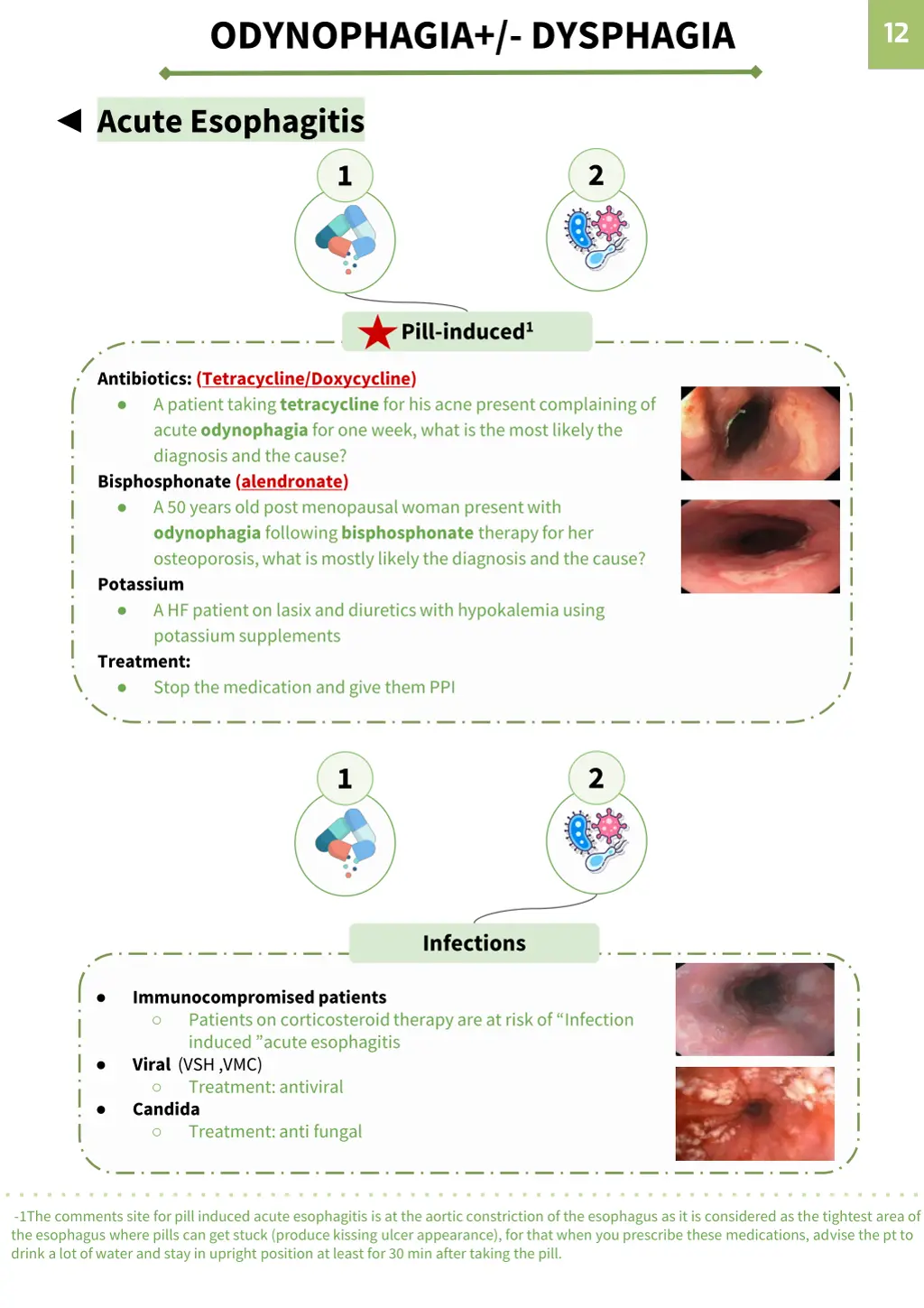 odynophagia dysphagia