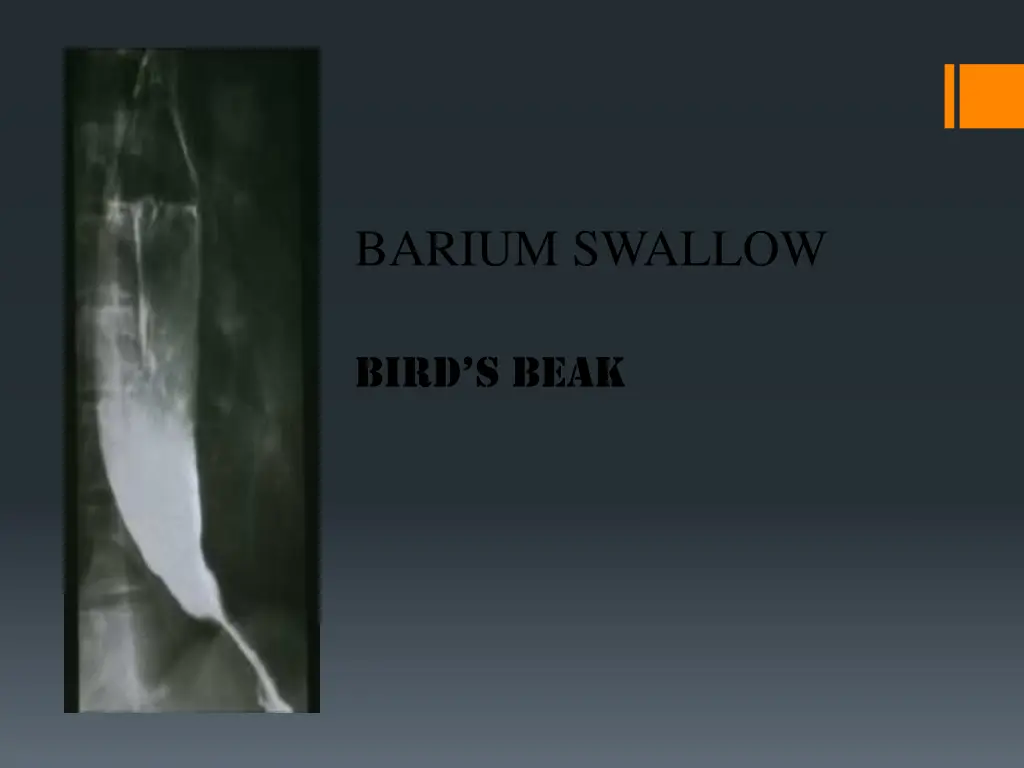 barium swallow