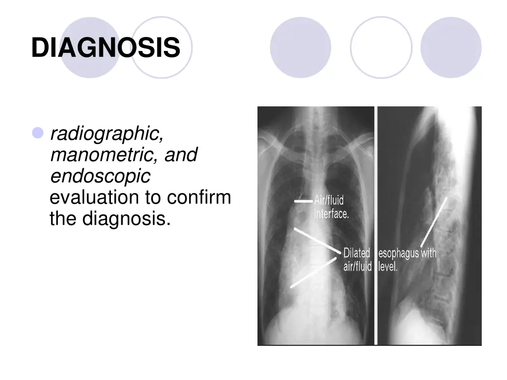 diagnosis