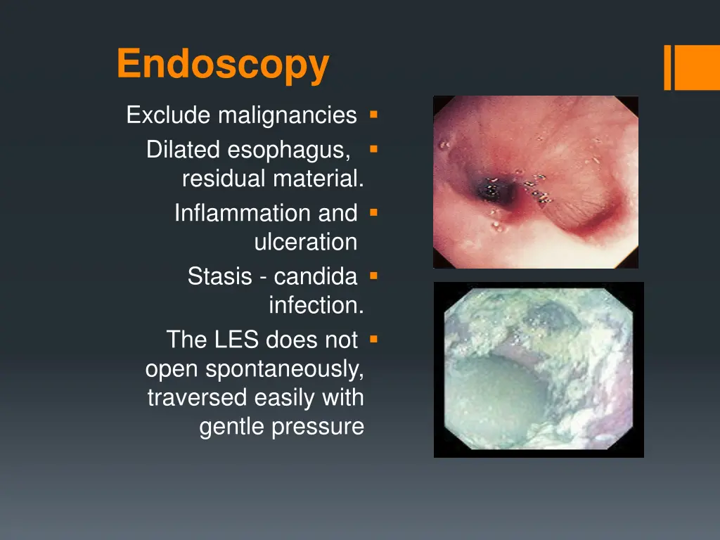 endoscopy