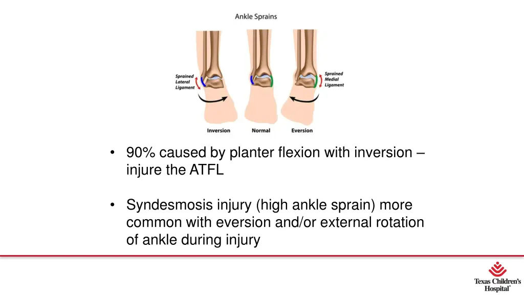 90 caused by planter flexion with inversion