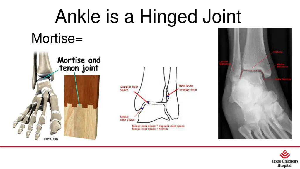 ankle is a hinged joint mortise