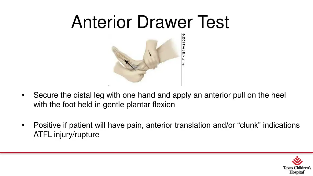 anterior drawer test