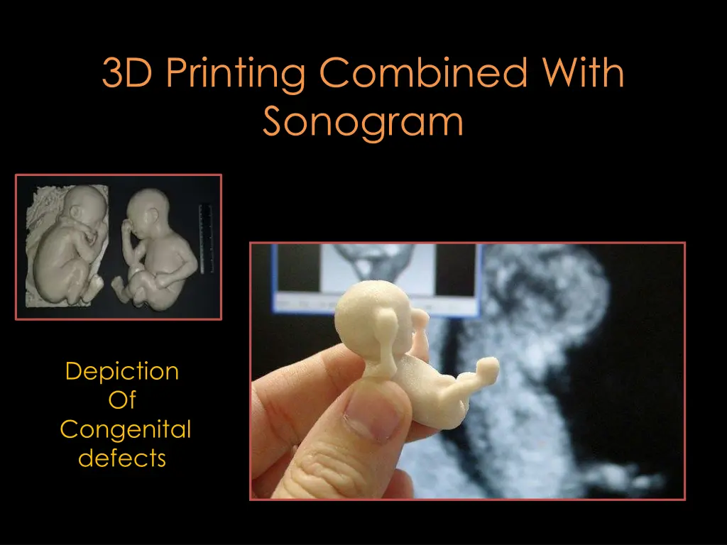 3d printing combined with sonogram