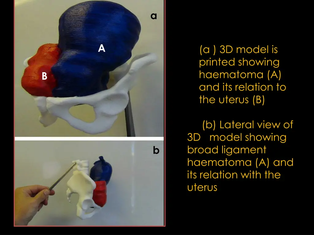 slide22