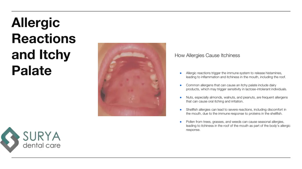 allergic reactions and itchy palate