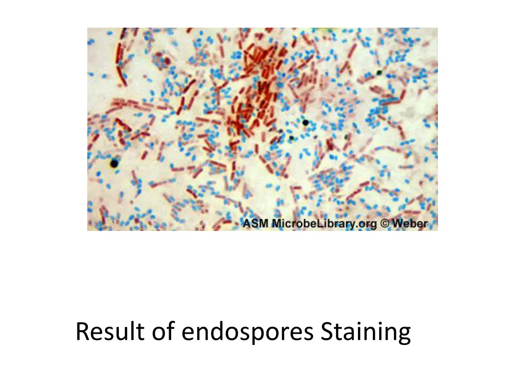 bacillus cereus endospore stain