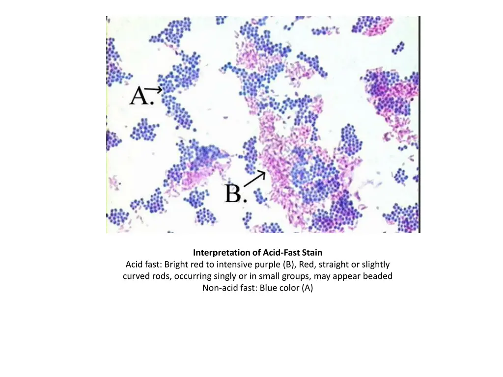 interpretation of acid fast stain