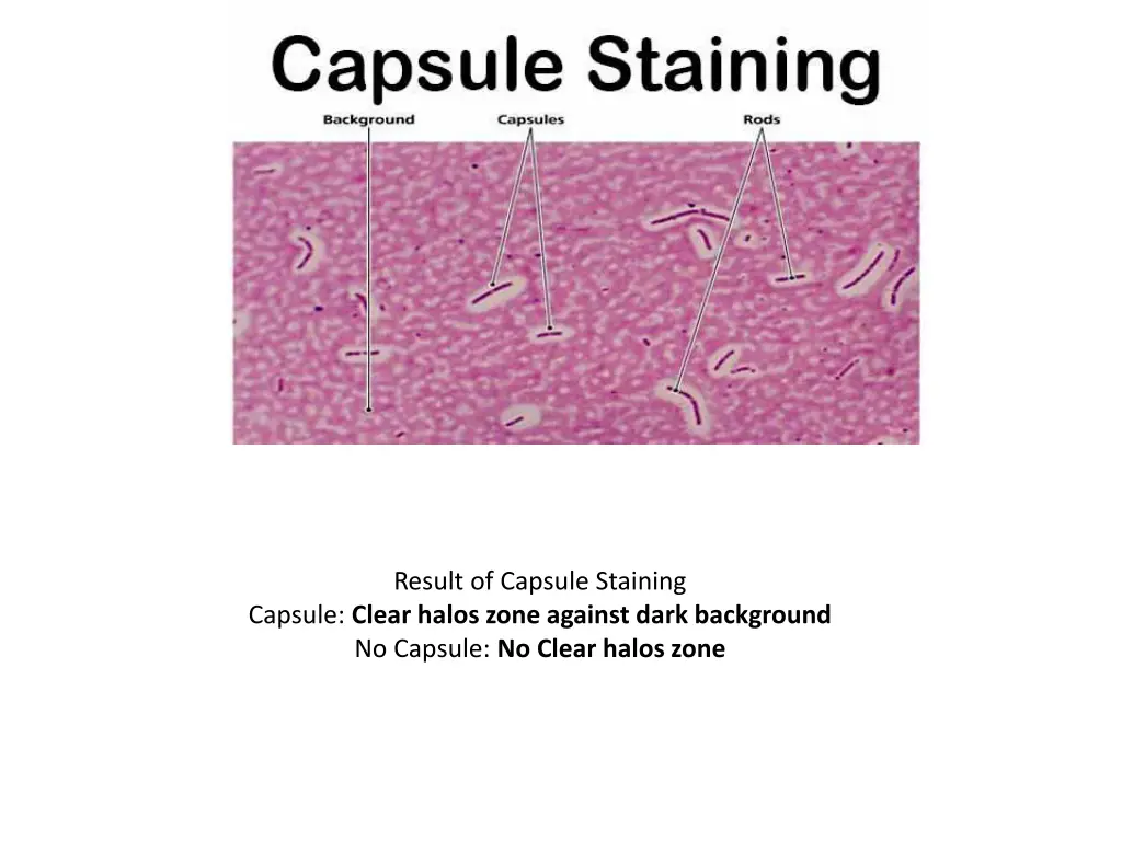 result of capsule staining capsule clear halos