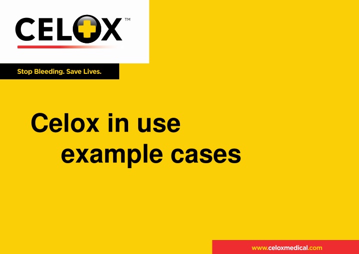 celox in use example cases