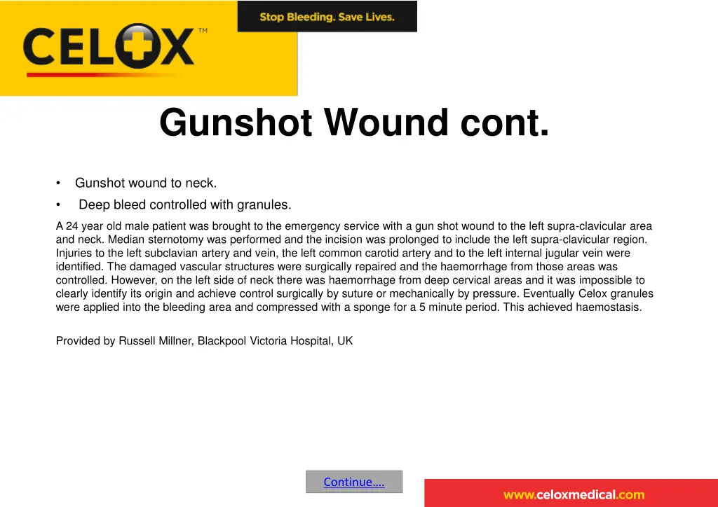 gunshot wound cont