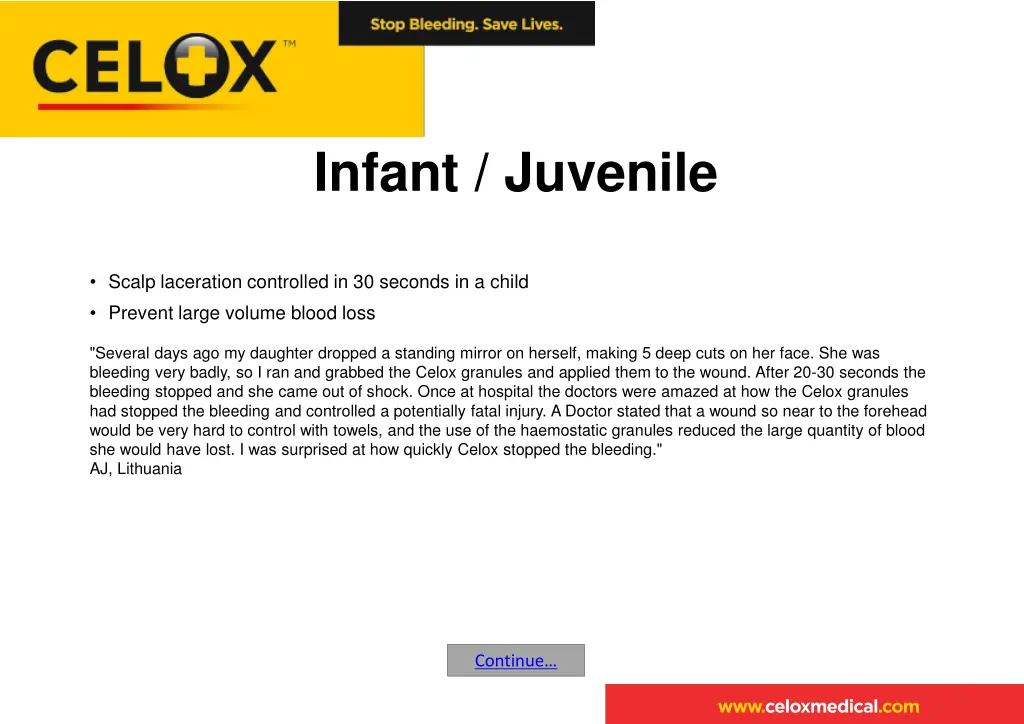 infant juvenile