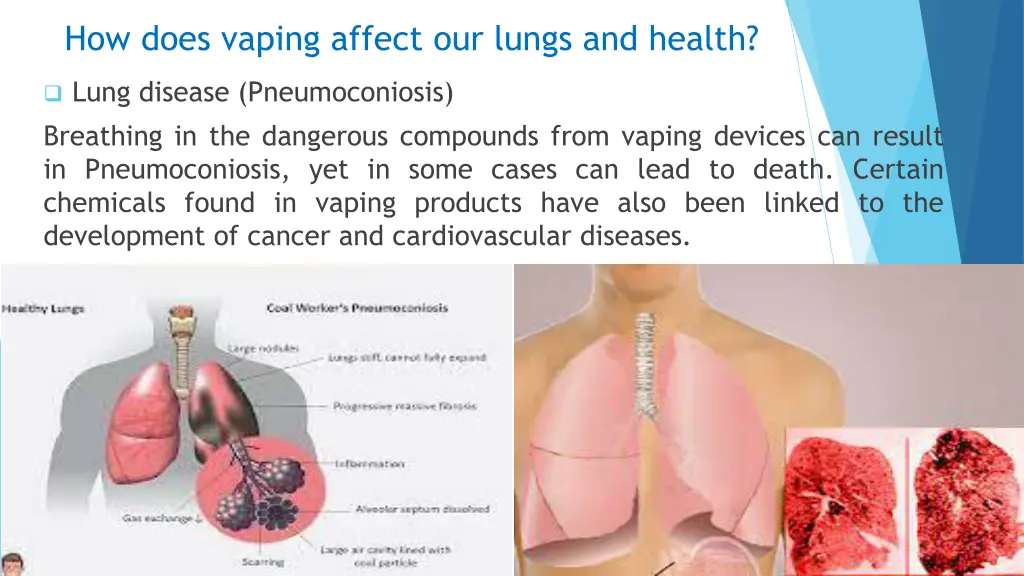 how does vaping affect our lungs and health 5