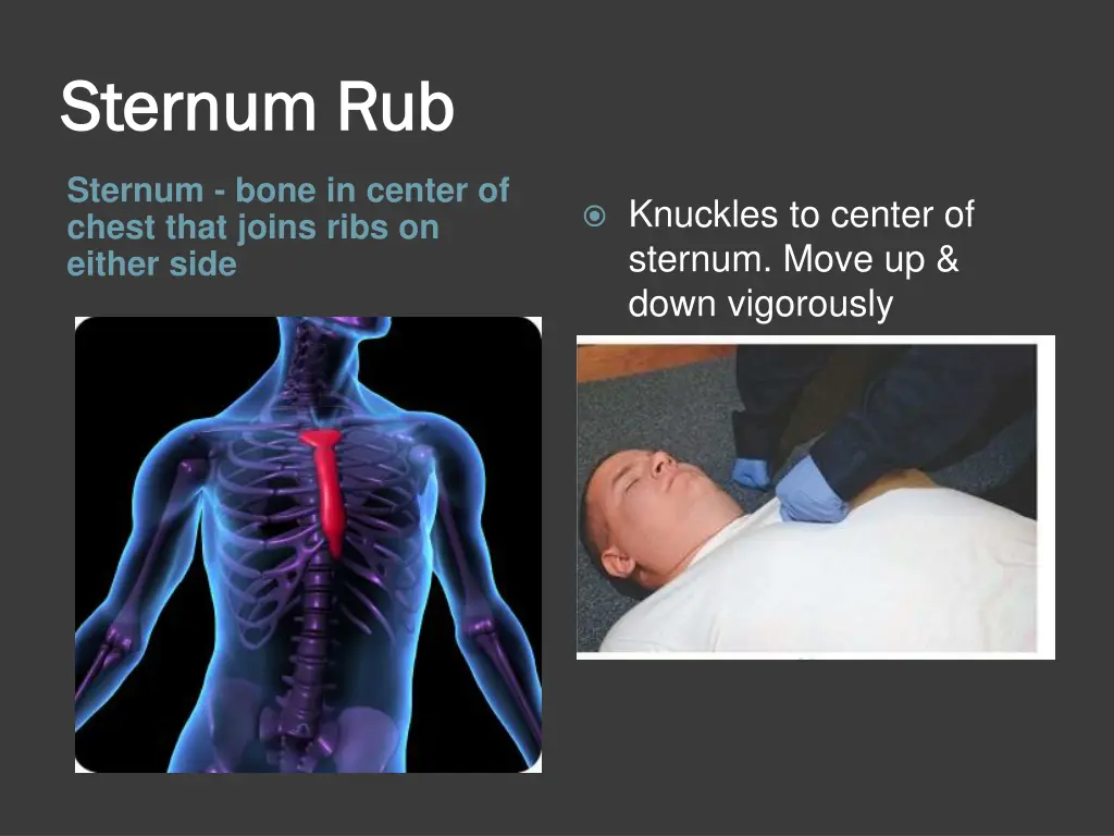 sternum rub sternum rub