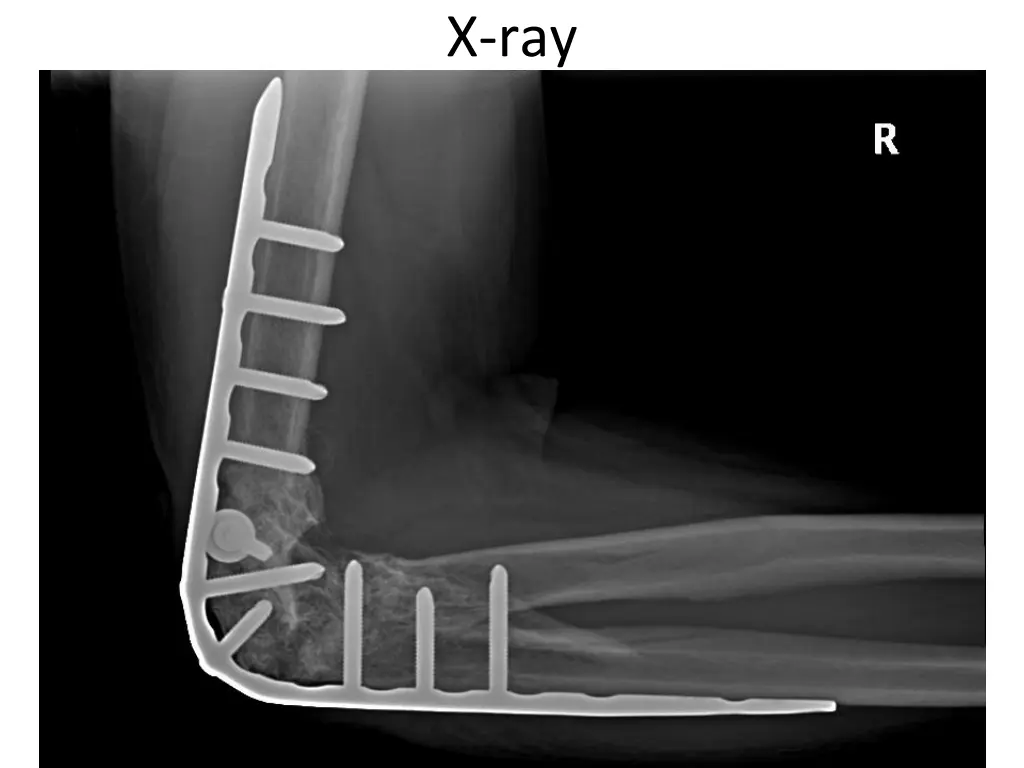 x ray 1