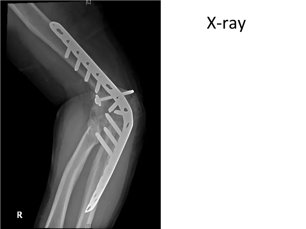 x ray