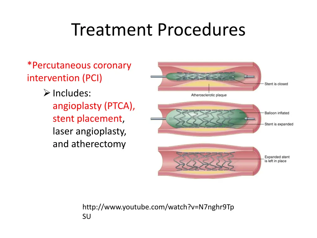 treatment procedures