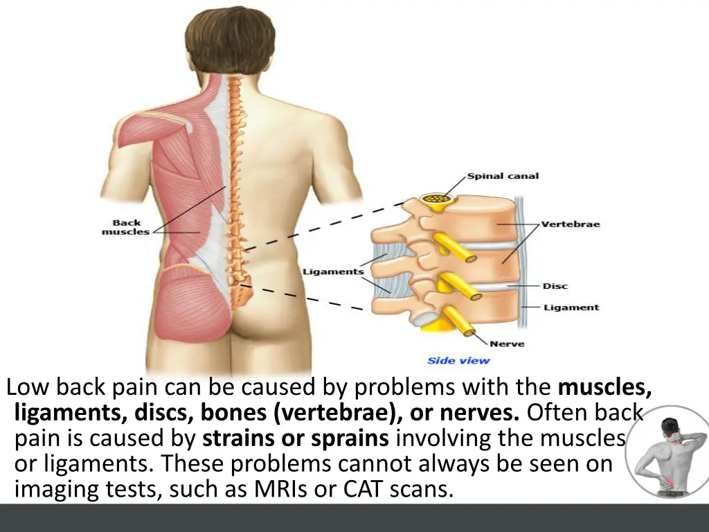 low back pain can be caused by problems with