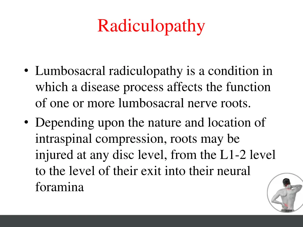 radiculopathy