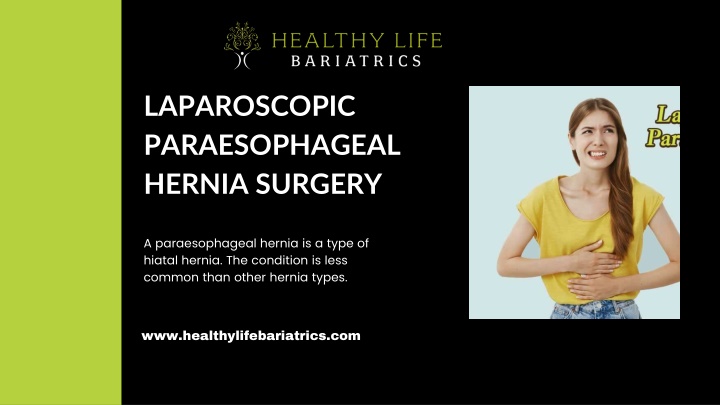 laparoscopic paraesophageal hernia surgery