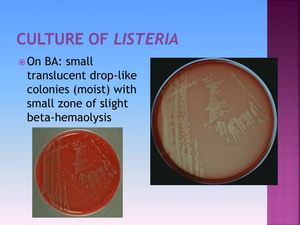 culture of listeria 1