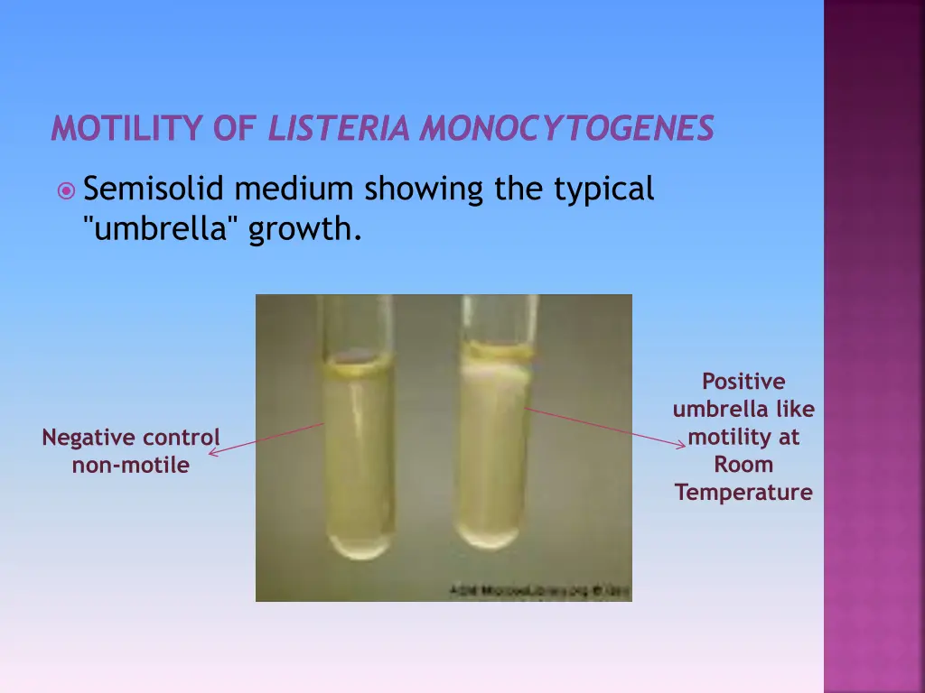 motility of listeria monocytogenes