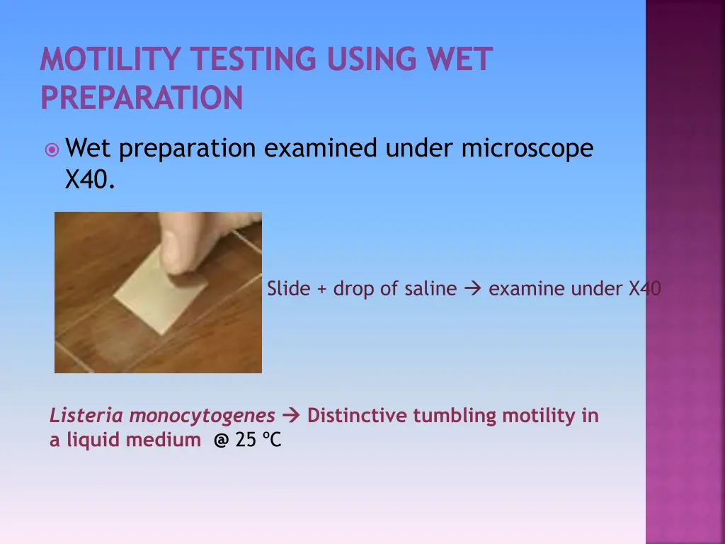 motility testing using wet preparation